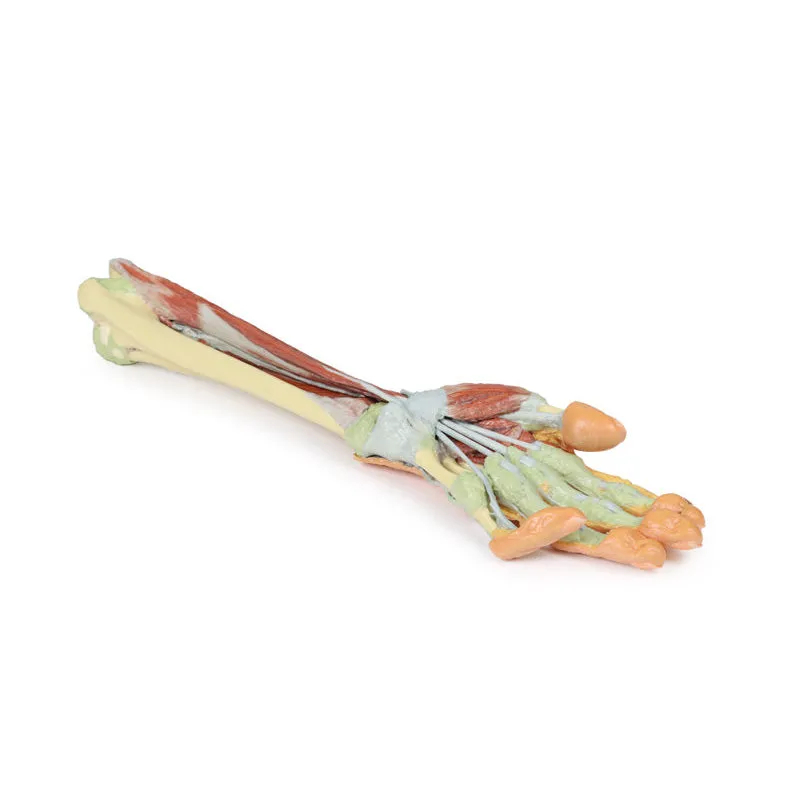 3D Printed Forearm and Hand with Deep Dissection