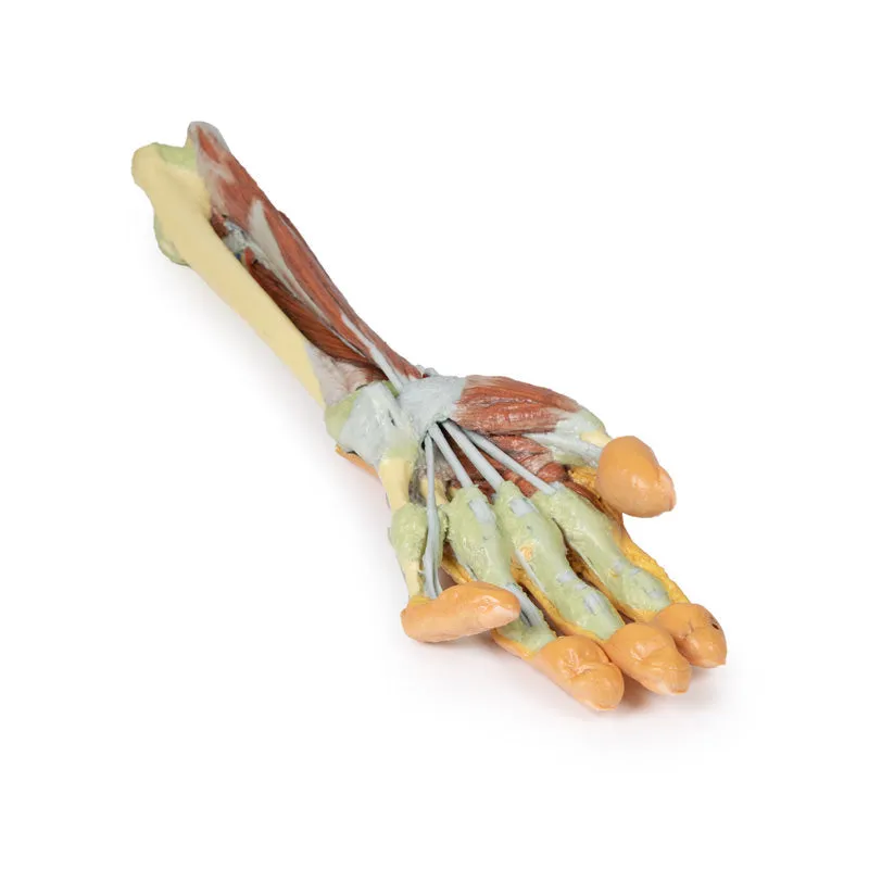 3D Printed Forearm and Hand with Deep Dissection