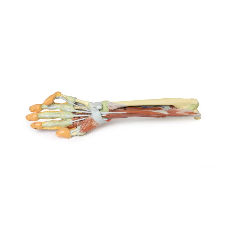 3D Printed Forearm and Hand with Deep Dissection