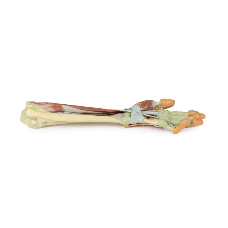 3D Printed Forearm and Hand with Deep Dissection