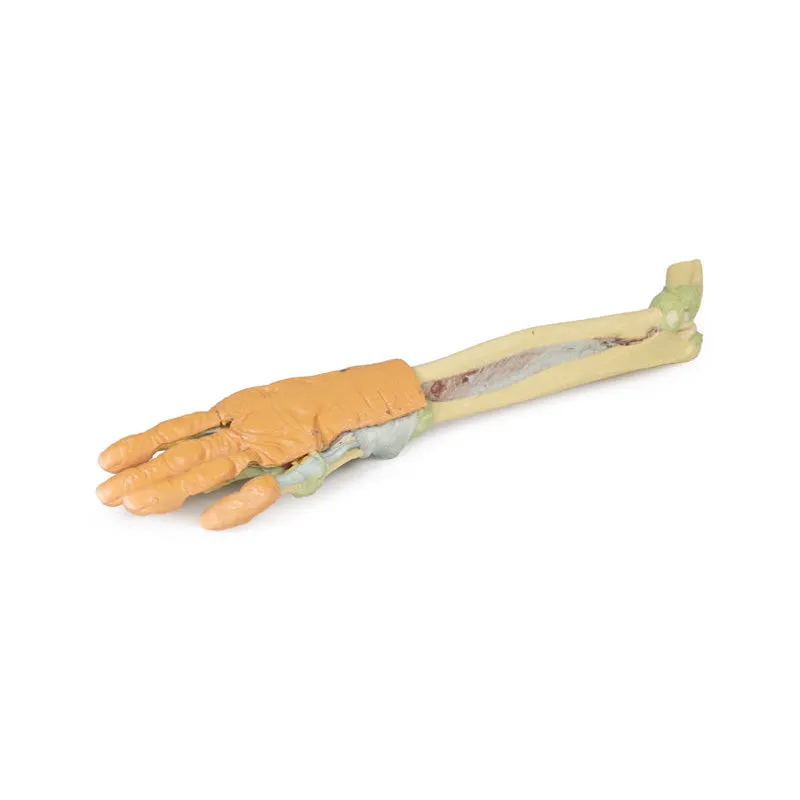 3D Printed Forearm and Hand with Deep Dissection