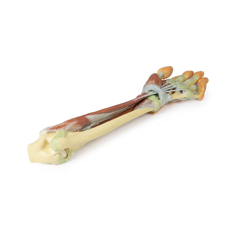 3D Printed Forearm and Hand with Deep Dissection