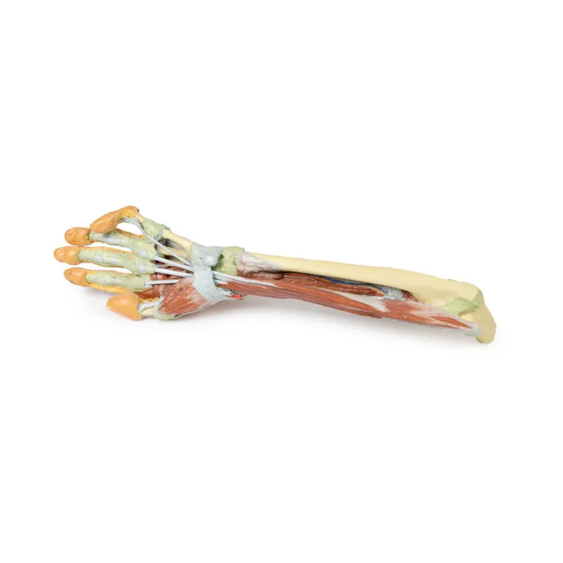 3D Printed Forearm and Hand with Deep Dissection
